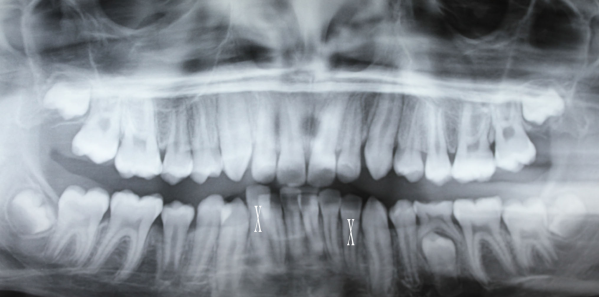 Aus Case Report Ortho Xray